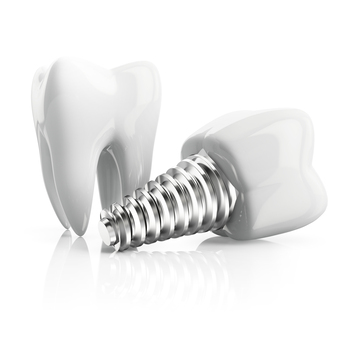 elderly teeth implant perth