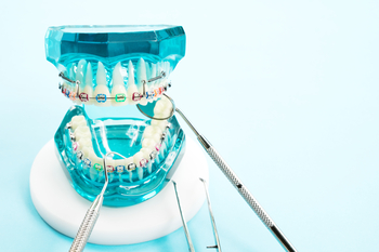 
inexpensive dental implants perth