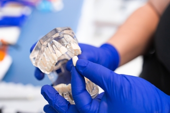tooth implant installment plan perth