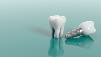 tooth implant overseas perth

